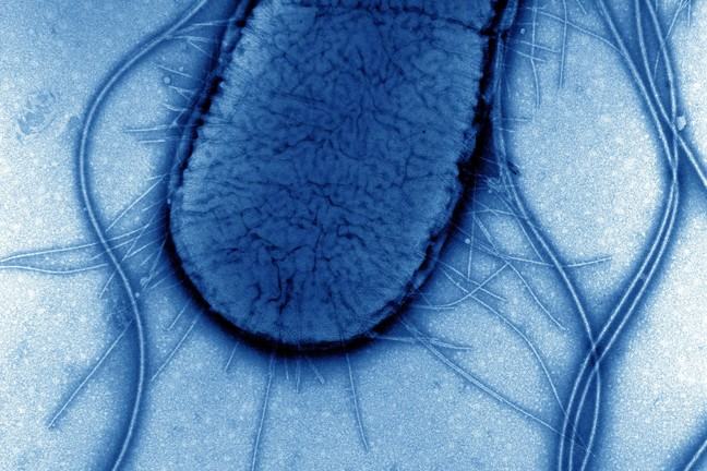 A transmission-electron microscopy image of an E. coli cell.
