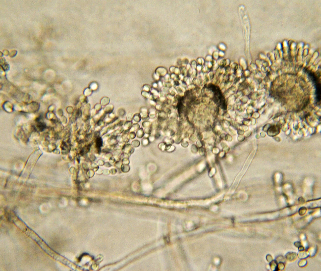 Aspergillus bread mould under a microscope