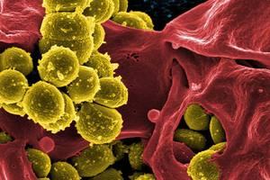 Cells seen under a microscope