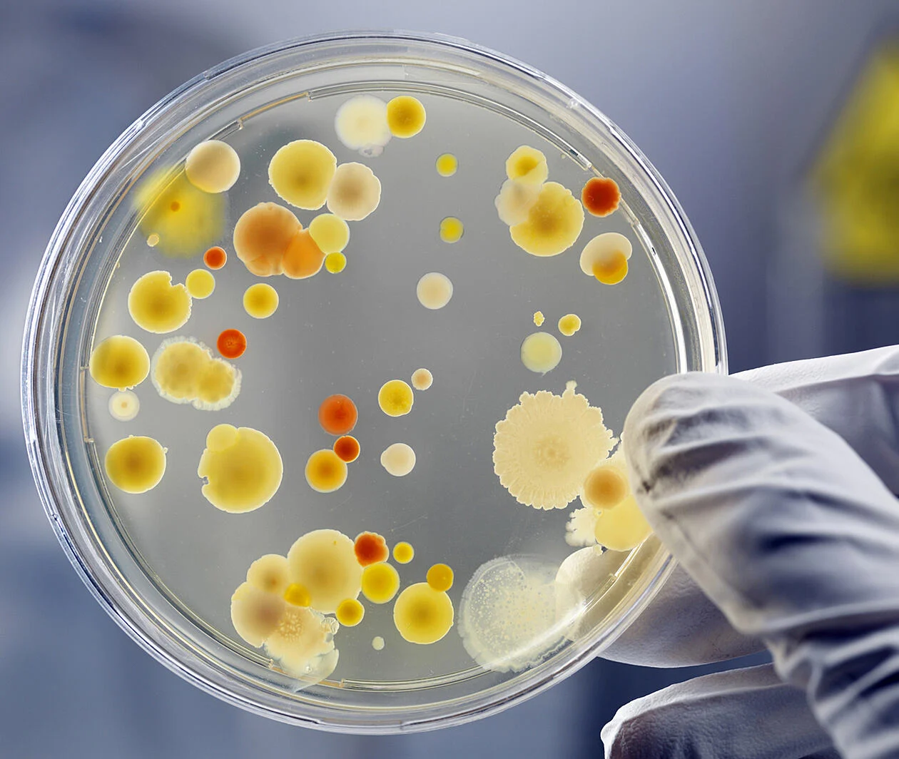 Petri dish with cultures