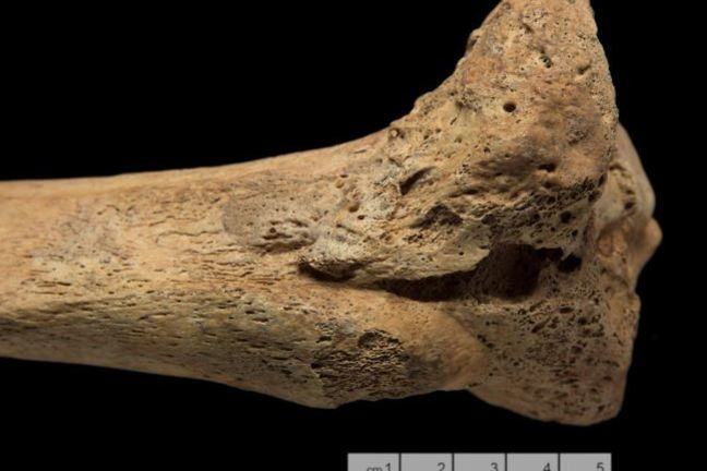 A tibia with new woven bone and lamellar bone present