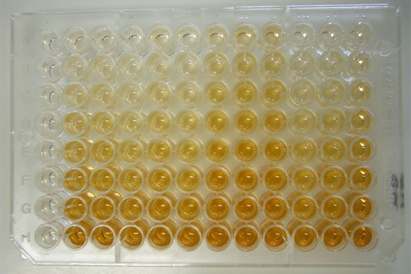 An ELISA (Enzyme-Linked Immunsorbent Assay) experiment