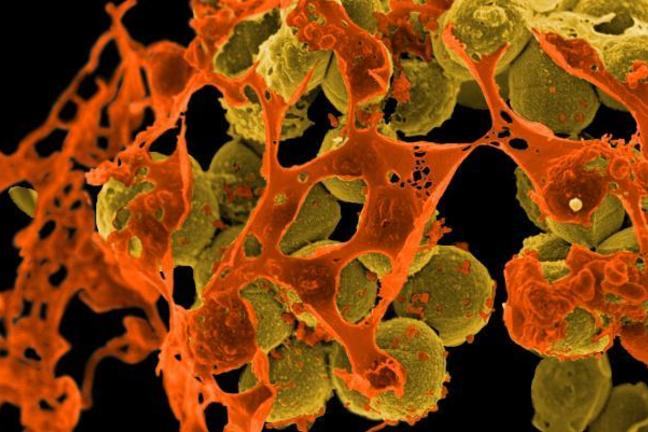 Microscopic view of Staphylococcus aureus