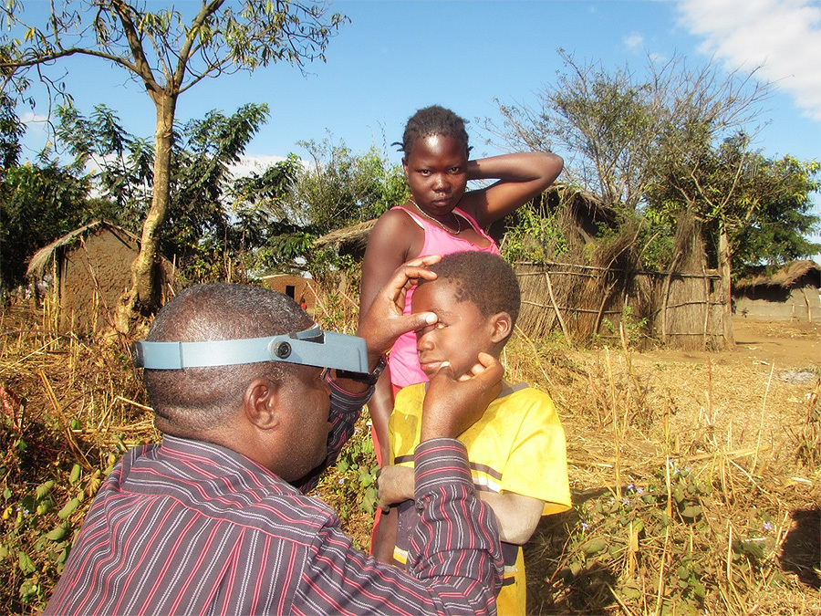 Examining a child for trachoma in the community