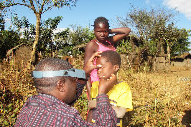 Examining a child for trachoma in the community