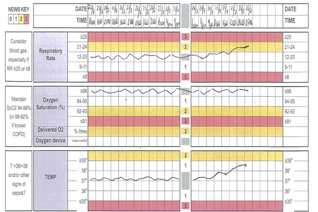A shot of part of the observation chart