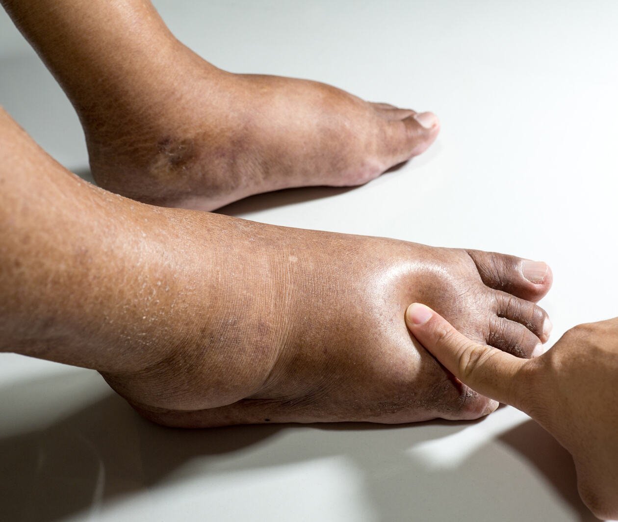 Exploring the Lymphatic System – Online Course – Futurelearn