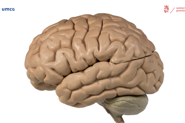 The left hemisphere