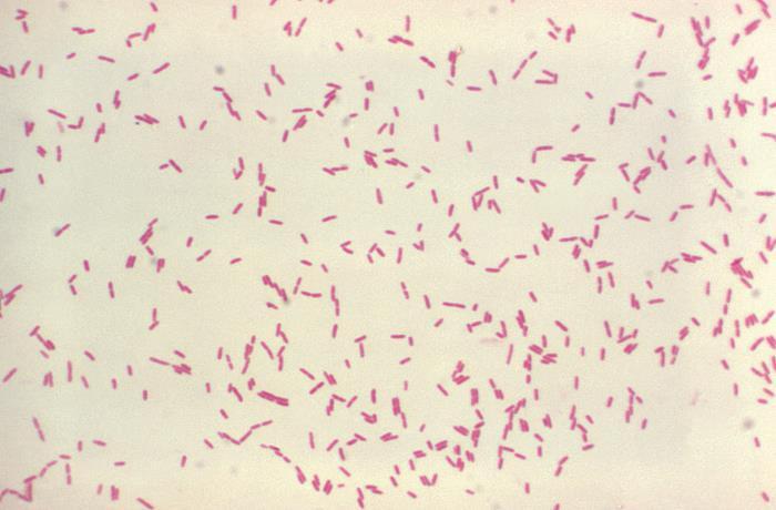 Introduction to Stenotrophomonas maltophilia