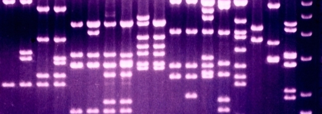 Gel Electrophoresis