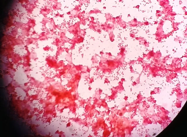 gram negative bacteria