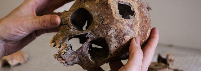 Archaeology: a human skull is examined in the lab.