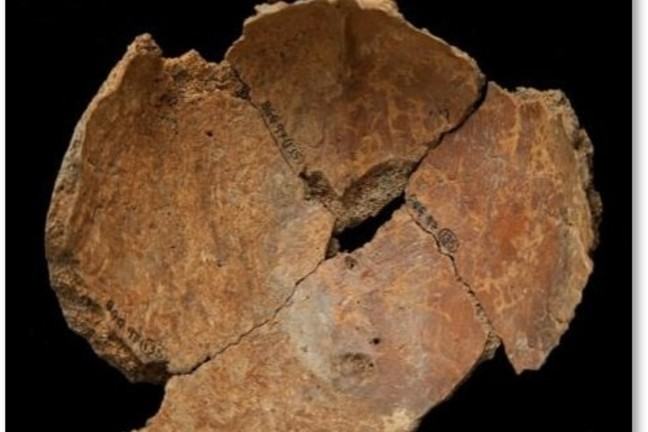 Inside surface of a piece of cranium that shows evidence of peri-mortem trauma