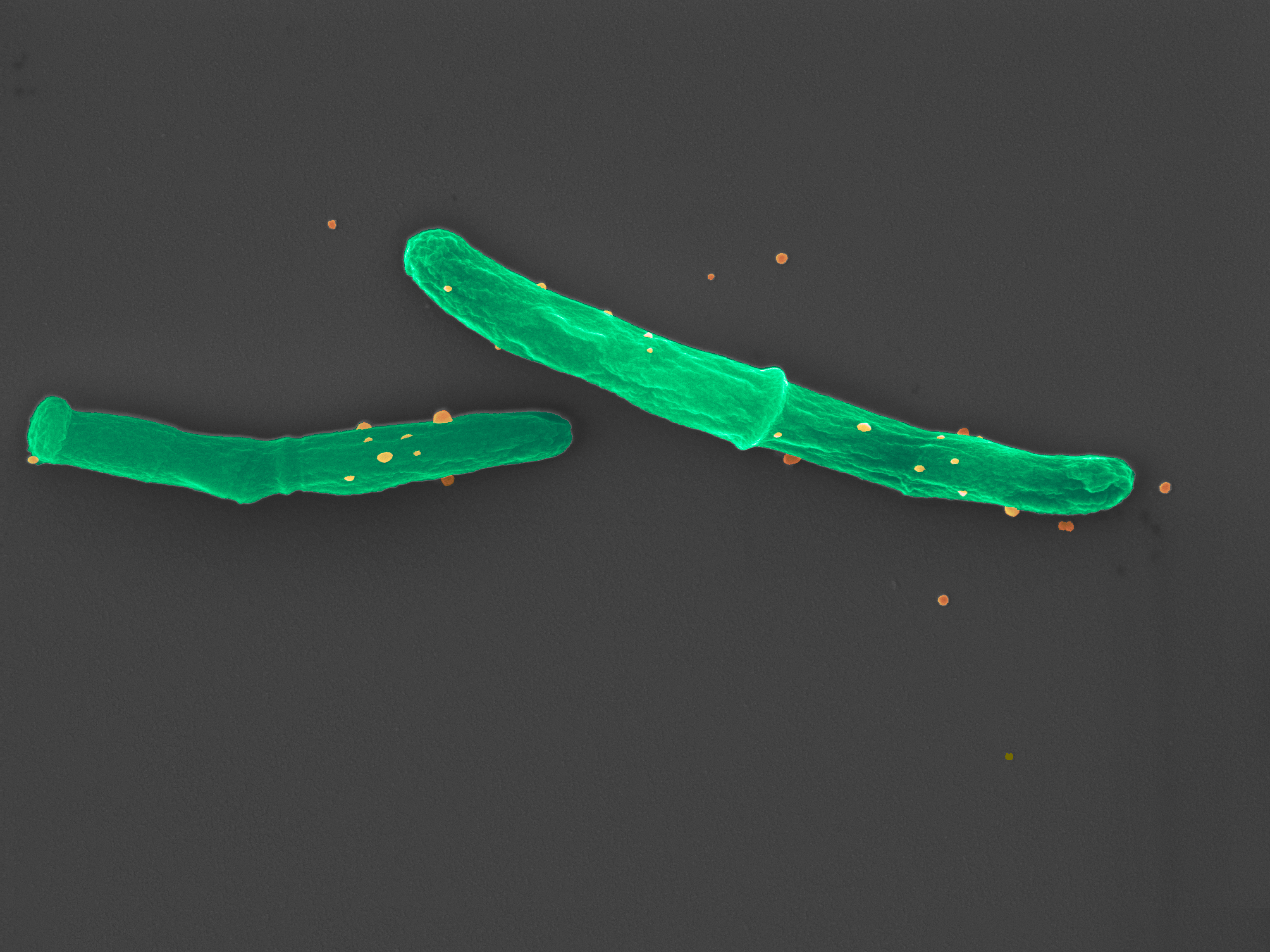 Tuberculosis bacteria