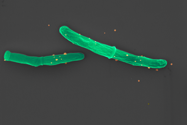 Tuberculosis bacteria