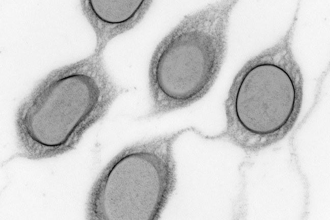 Klebsiella pneumoniae bacteria viewed by transmission electron microscopy