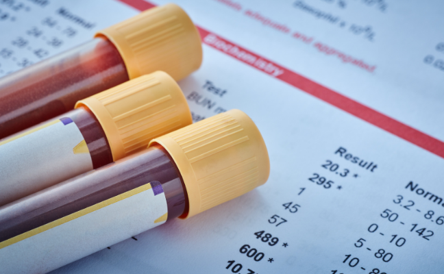 blood tubes alongside blood test results