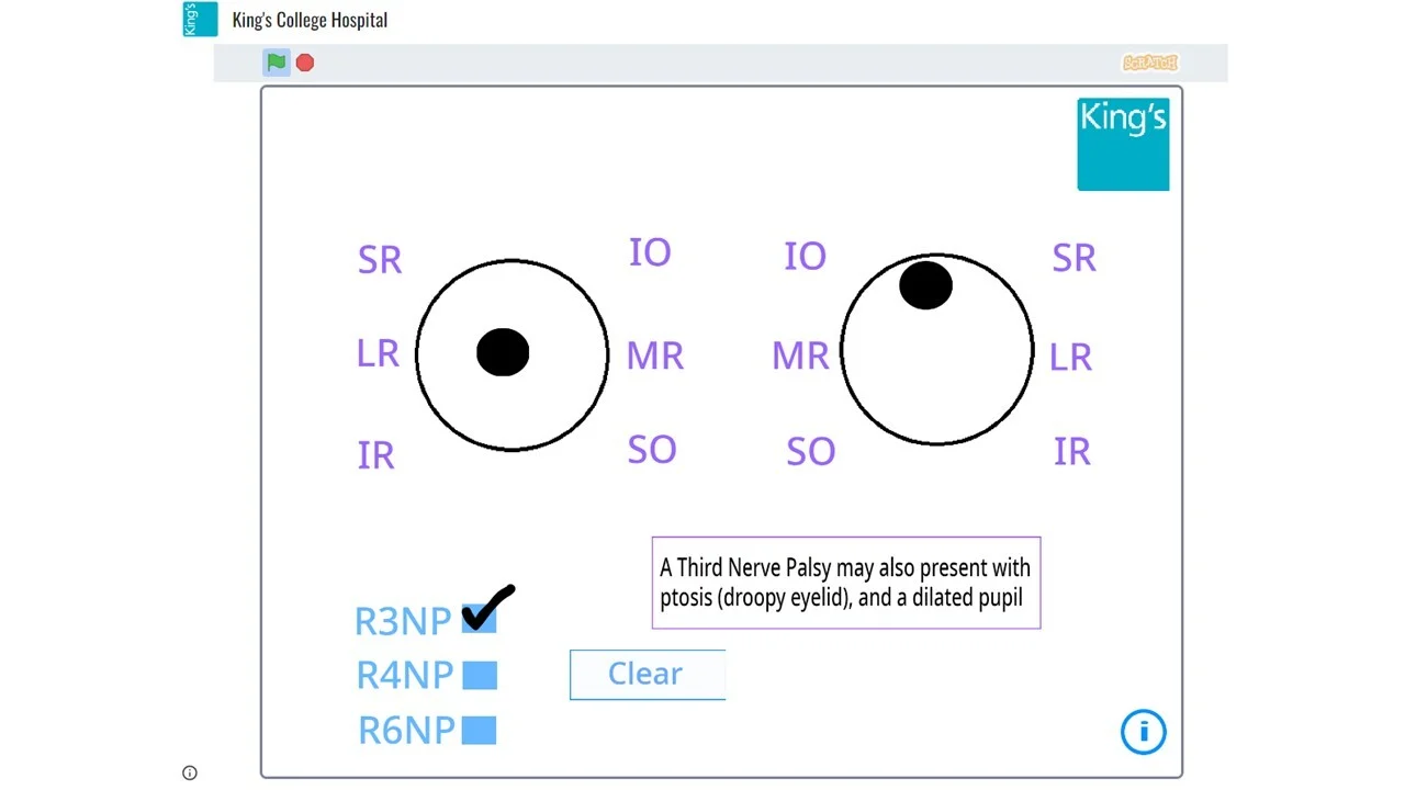 Interactive Eye Movements