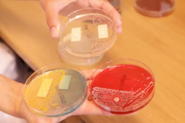 Hand holding agar plates.