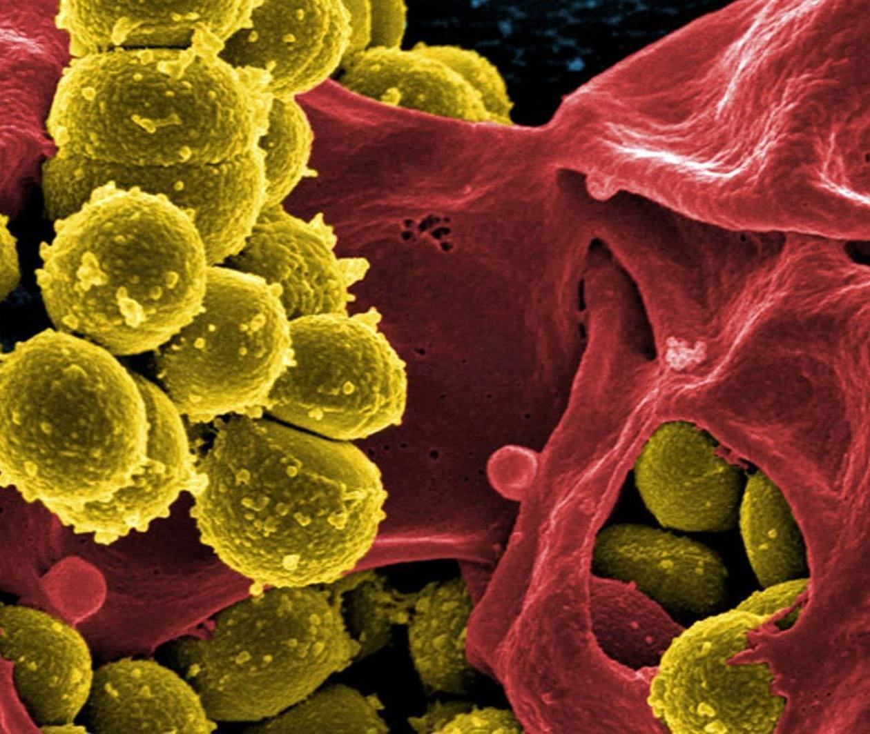 Optimización del uso de antimicrobianos: Gestión de la resistencia a los antimicrobianos