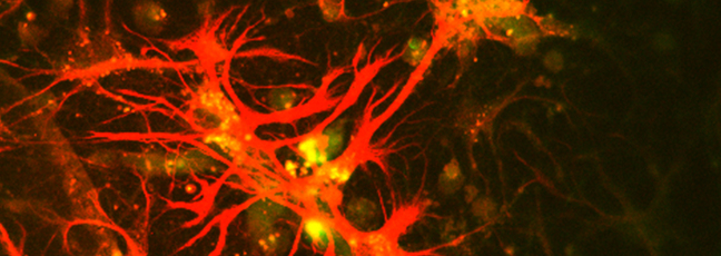 Cancer cells